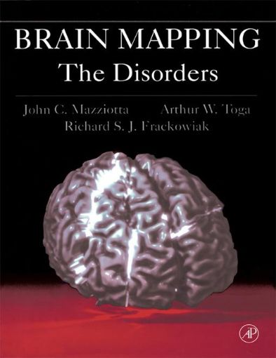 Picture of Brain Mapping: The Disorders: The Disorders