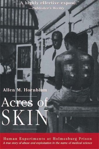Picture of Acres of Skin: Human Experiments at Holmesburg Prison